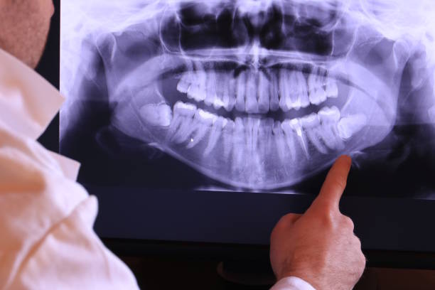 Best Emergency Dental Care for Trauma or Injury in St Cloud, MN