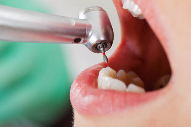 Best Emergency Treatment for Toothache in St Cloud, MN